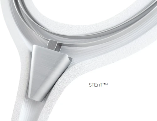 Mechanizm STEnT